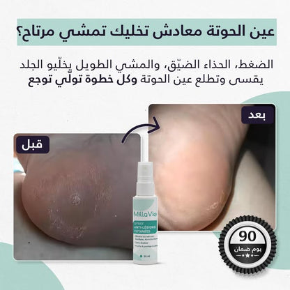 MillaVie Spray Anti-Lésions Cutanées 30ml