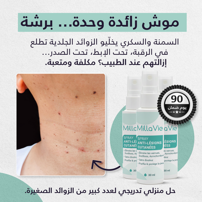 MillaVie Spray Anti-Lésions Cutanées 30ml